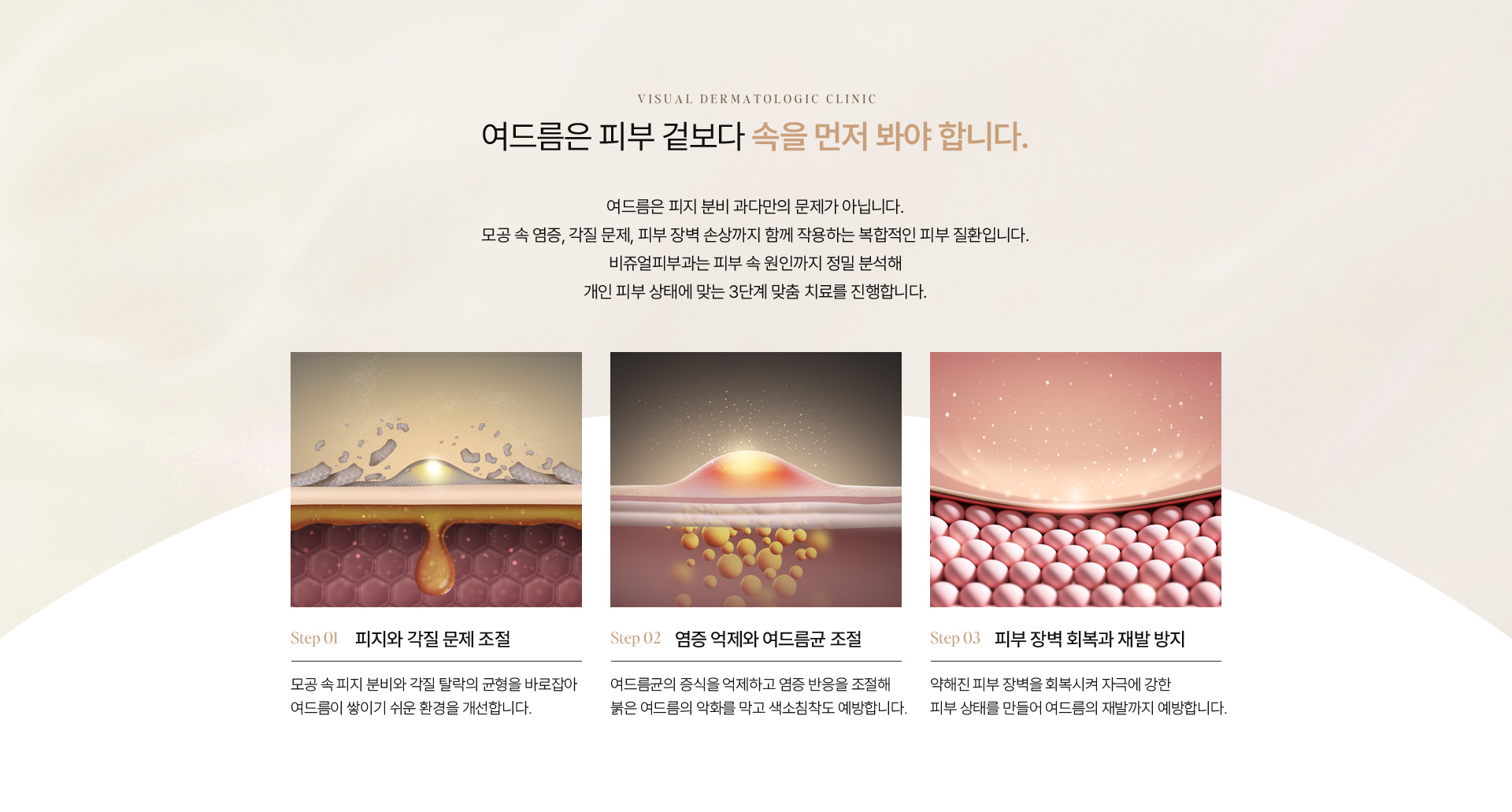 여드름 07