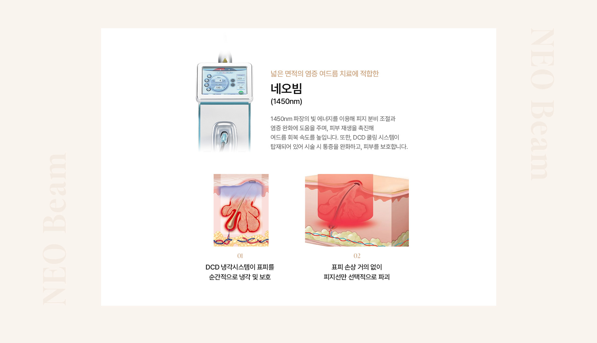 여드름 10