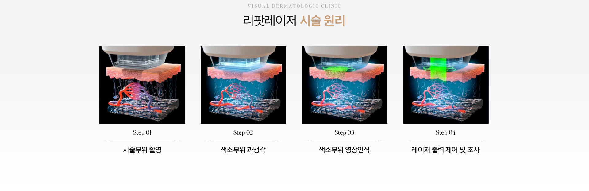 흑자검버섯 11
