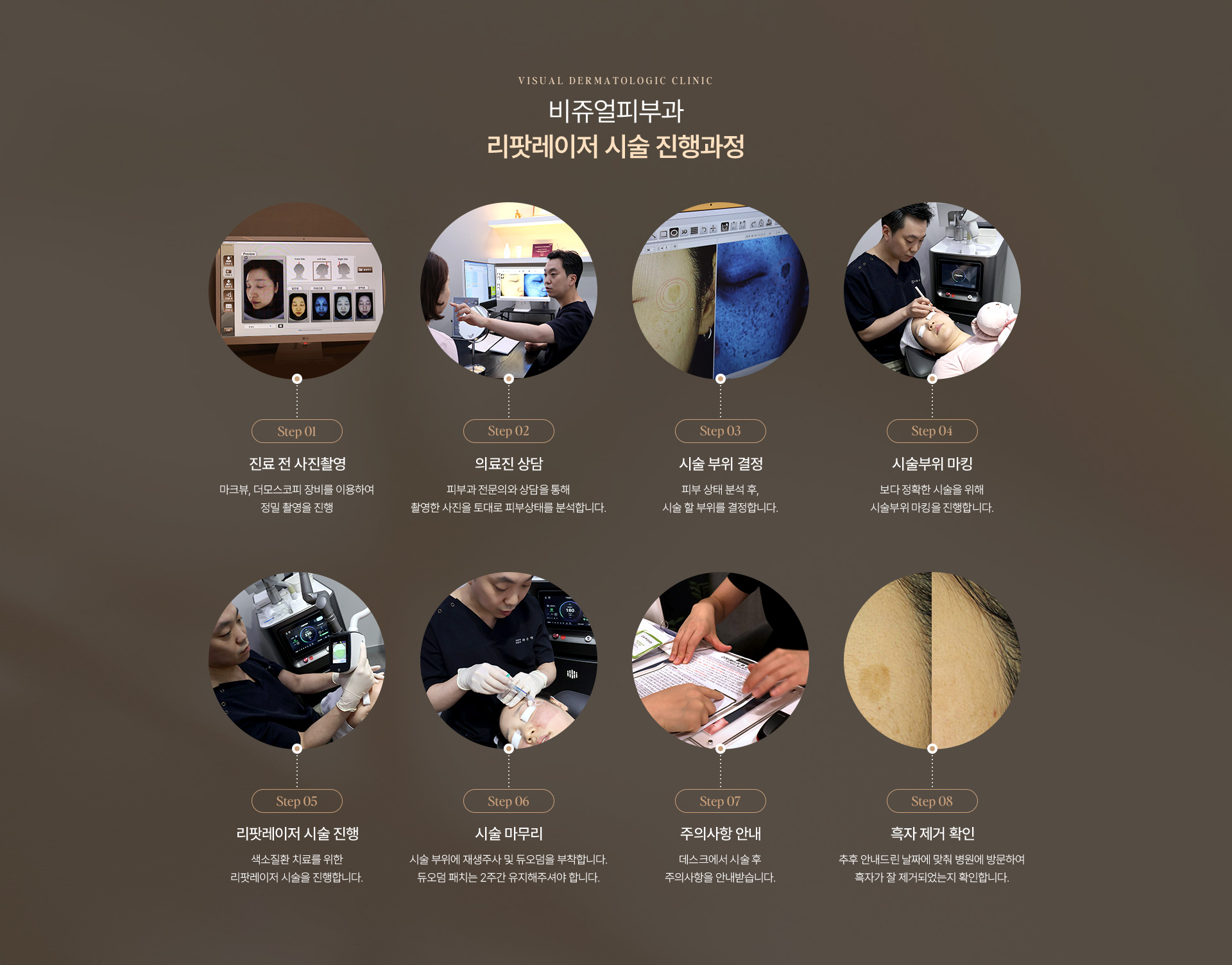 흑자검버섯 12