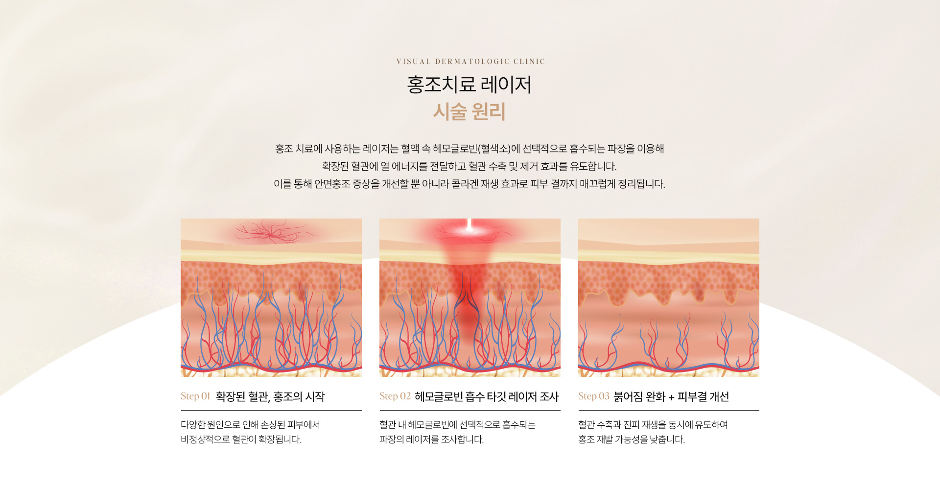 홍조 11