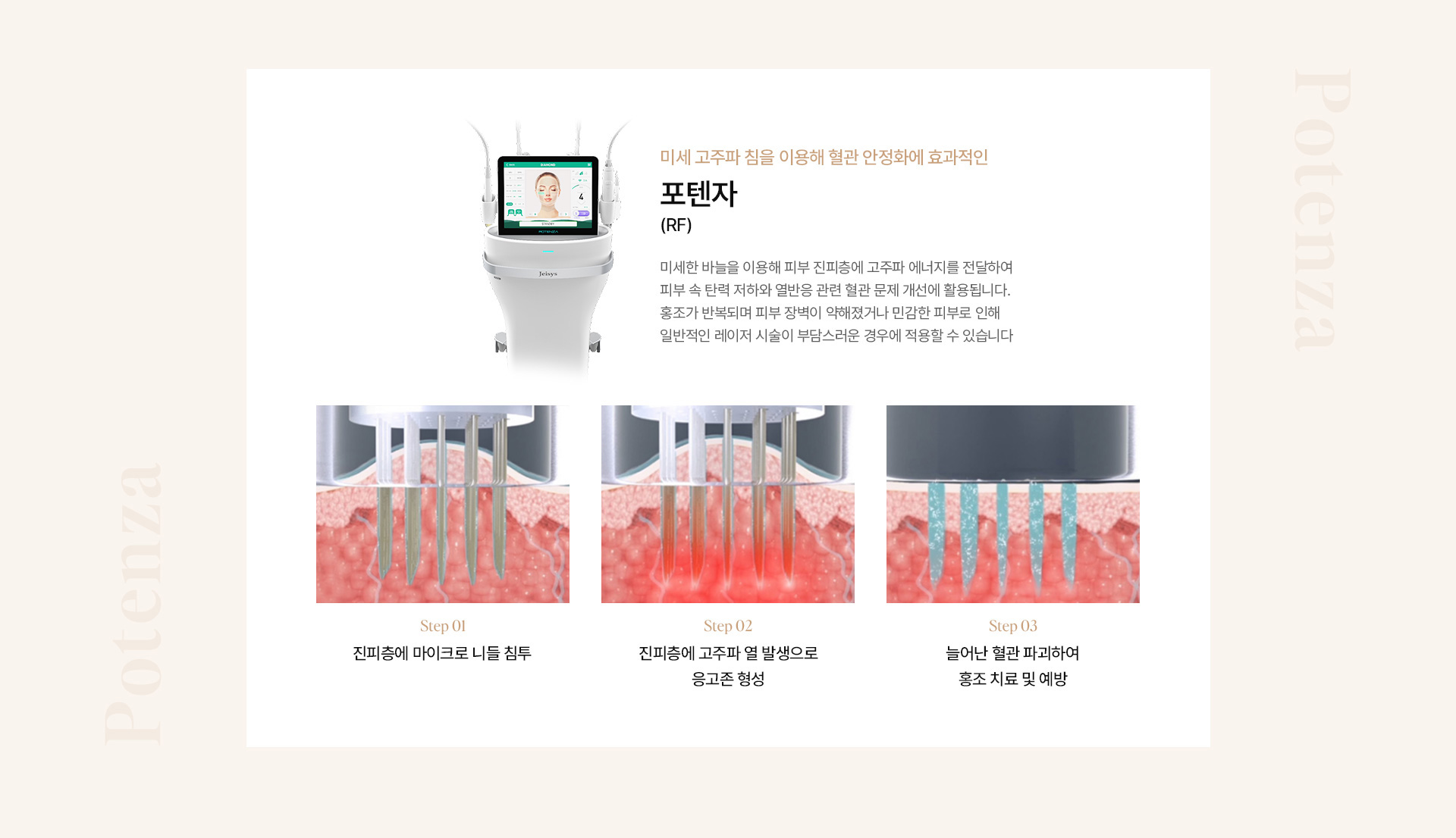 홍조 10