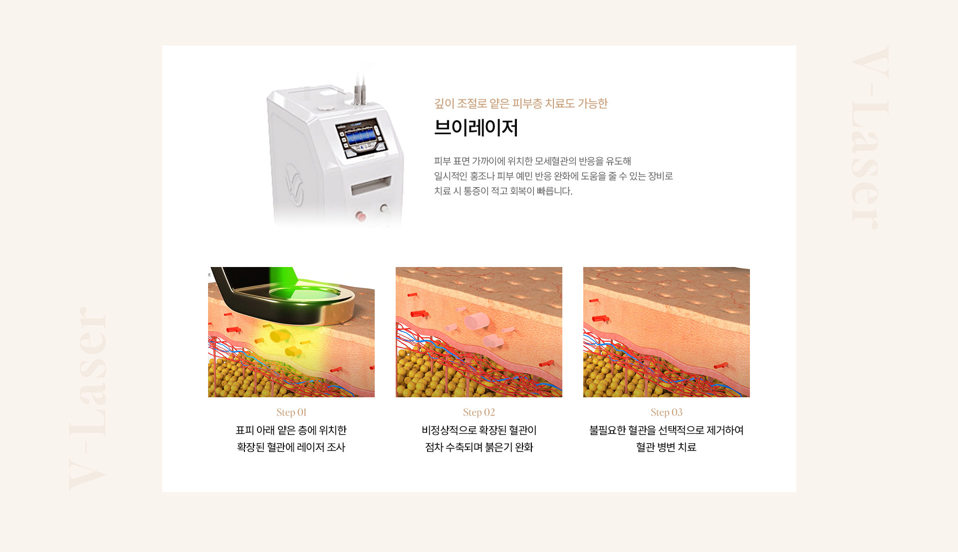 홍조 10