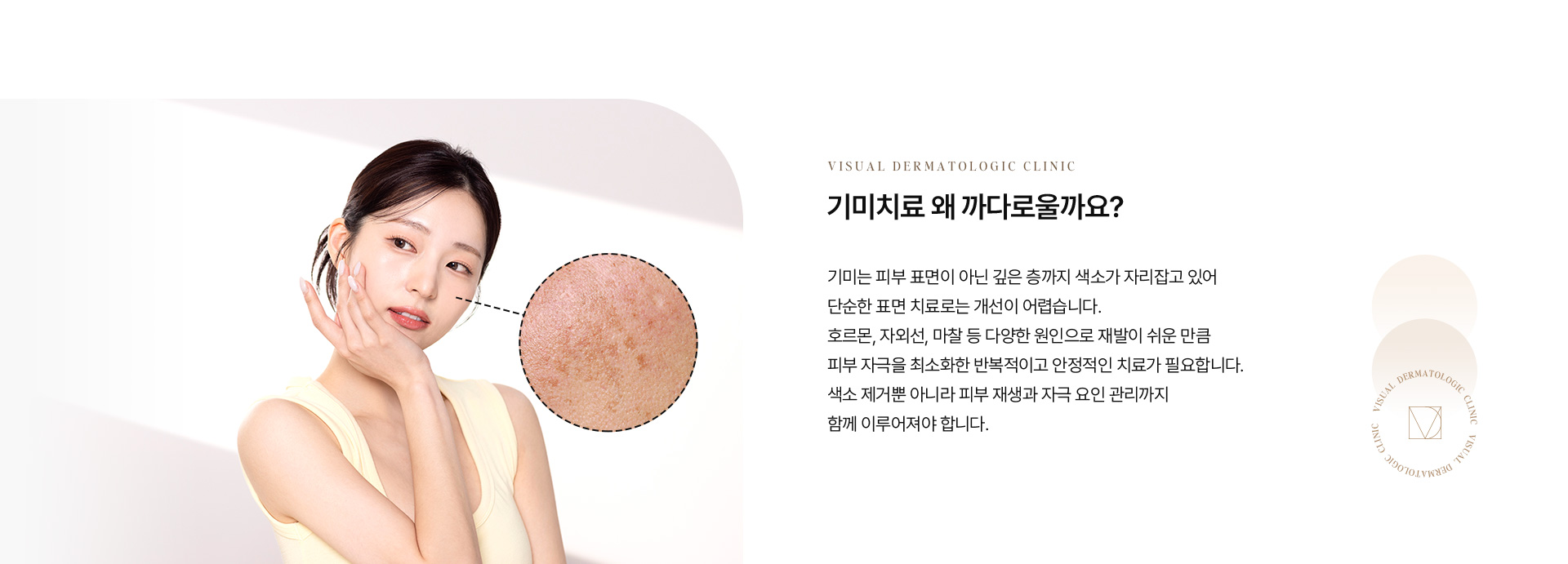 기미색소 02