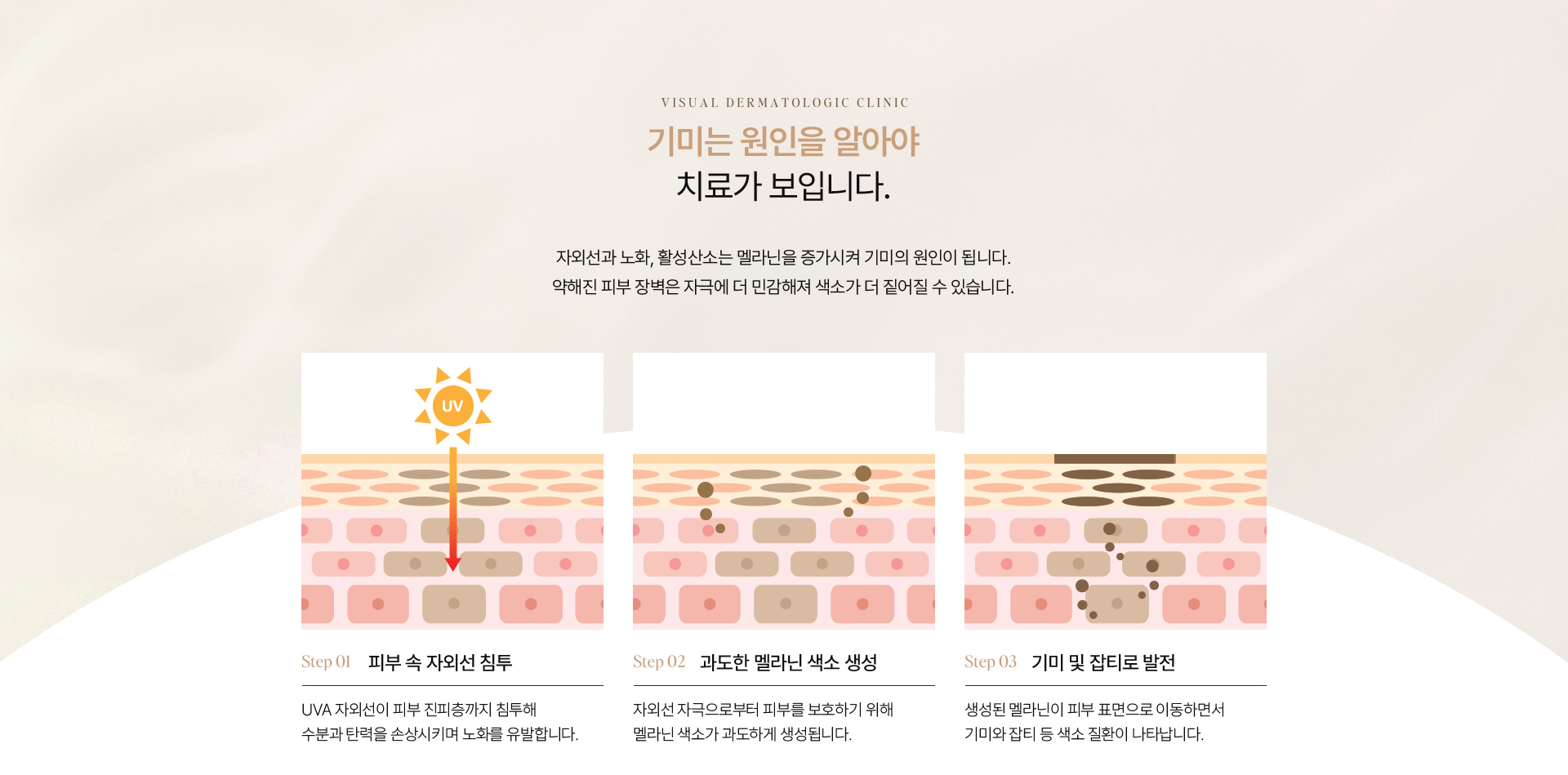 기미색소 06