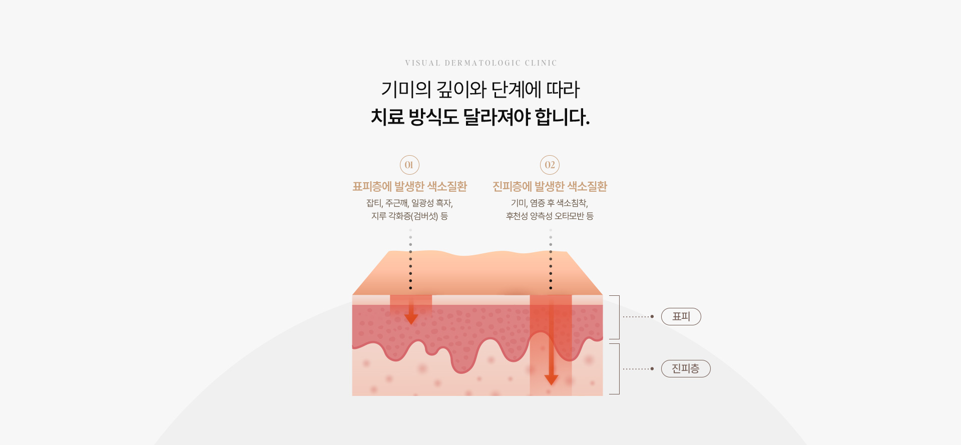 기미색소 08