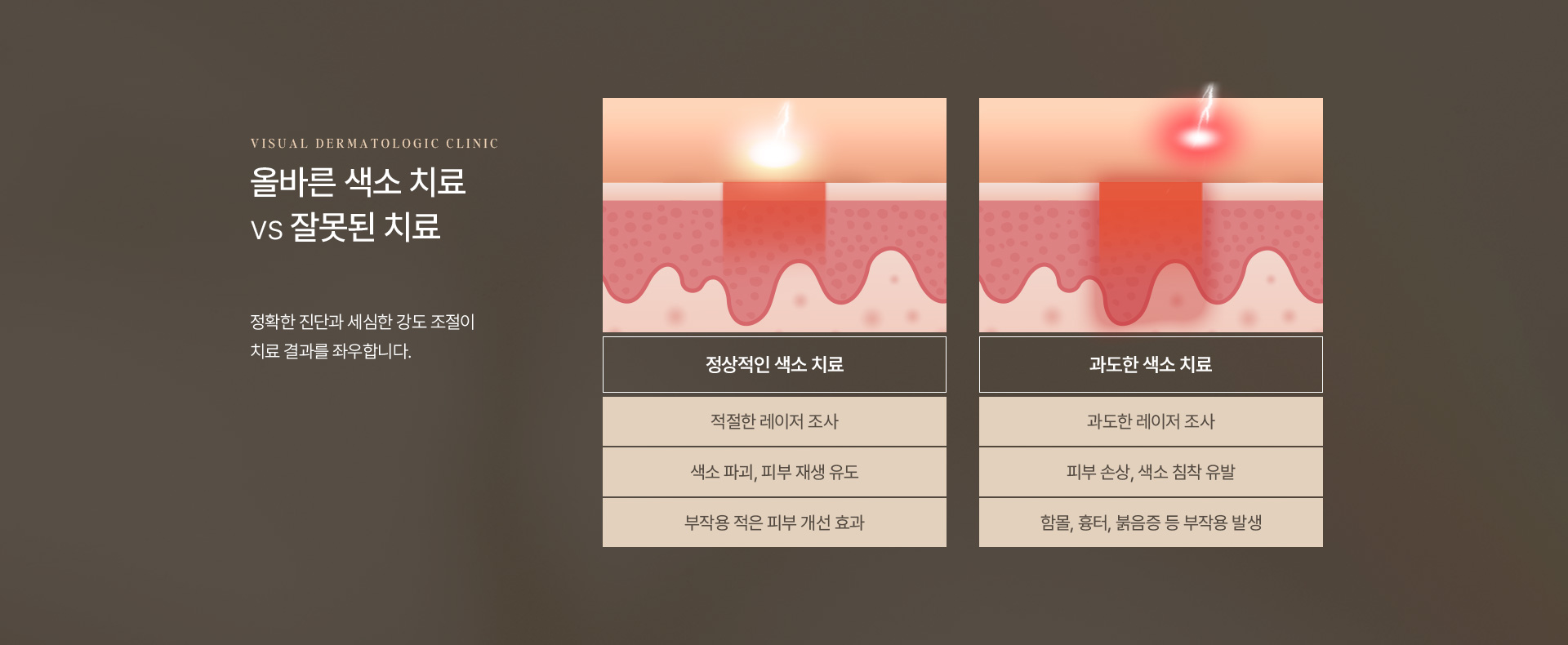 기미색소 09