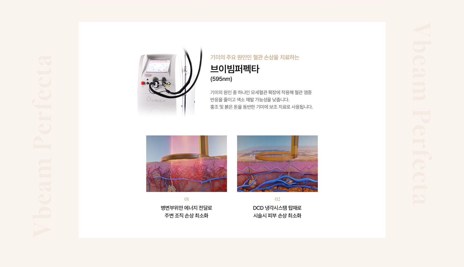 기미색소 10