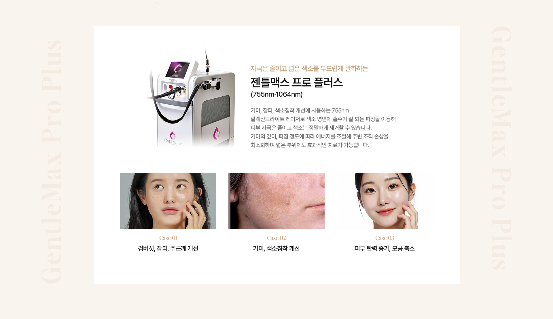 기미색소 10