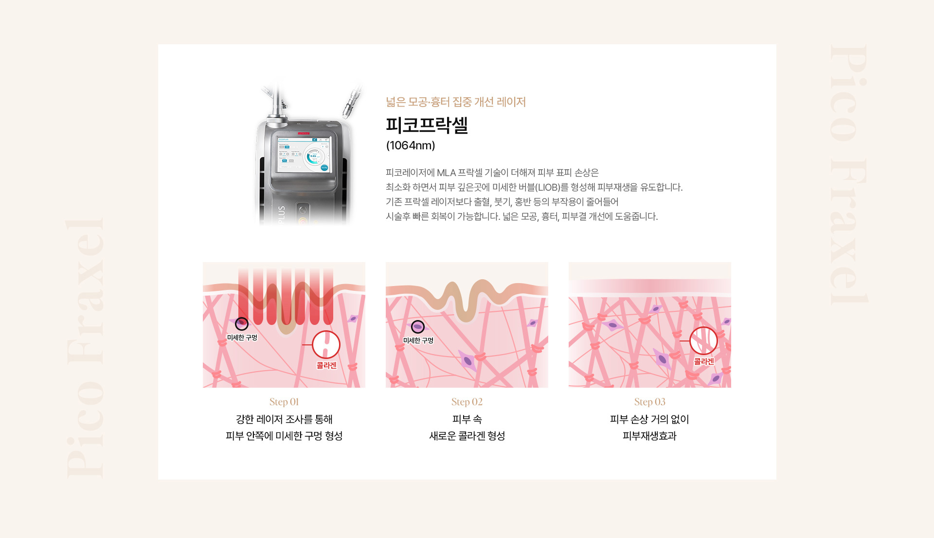 모공흉터 10