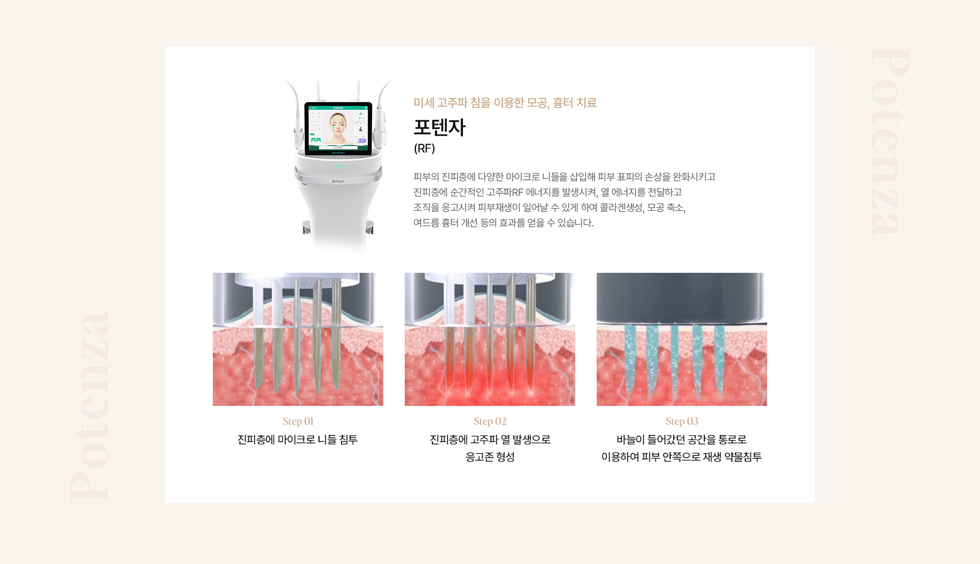 모공흉터 10