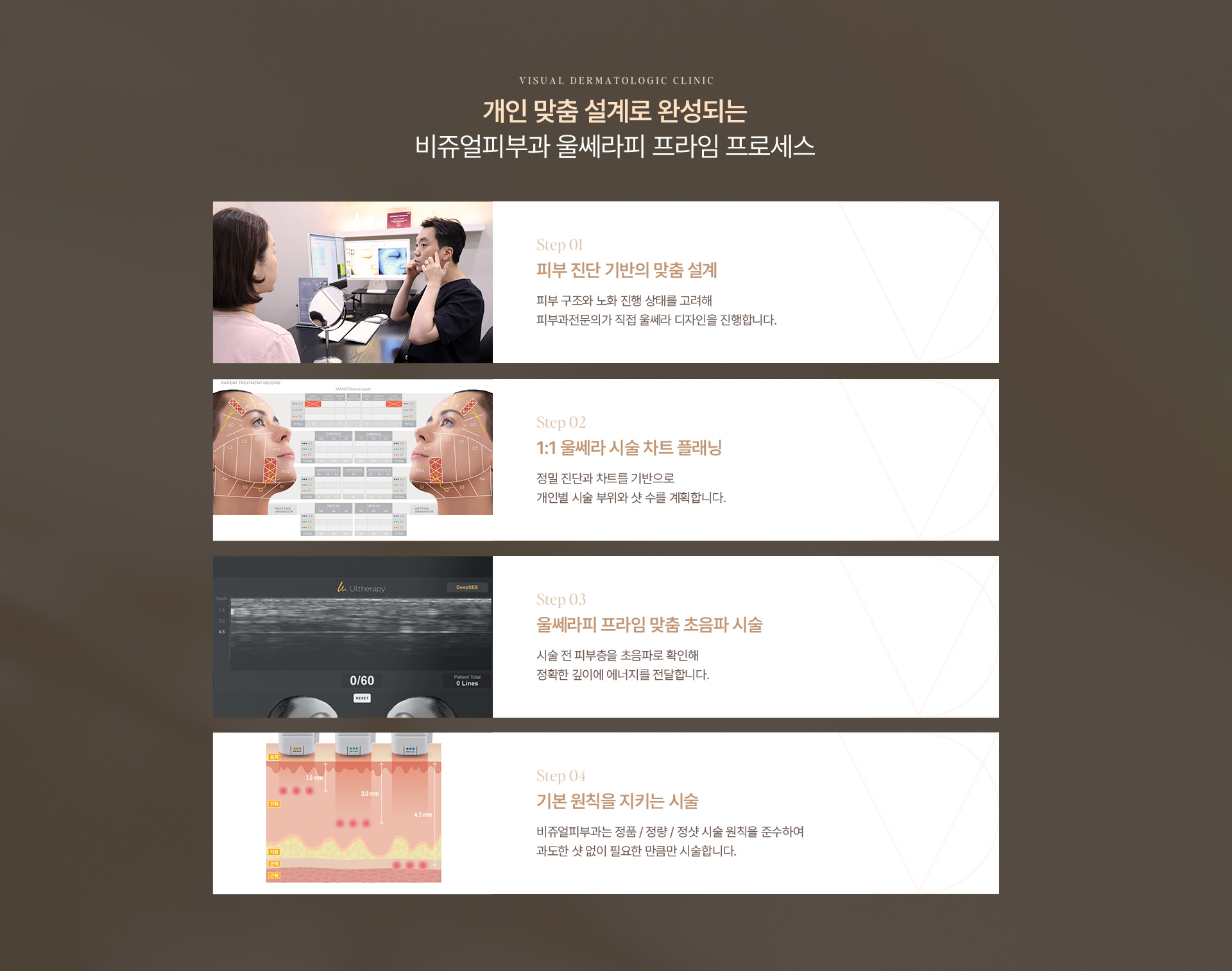울쎄라피 09