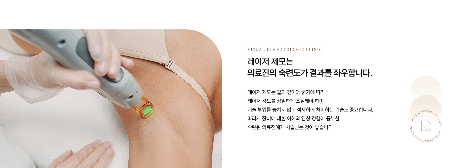 제모 02